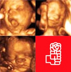 Ecografía 3D dos novos militantes.